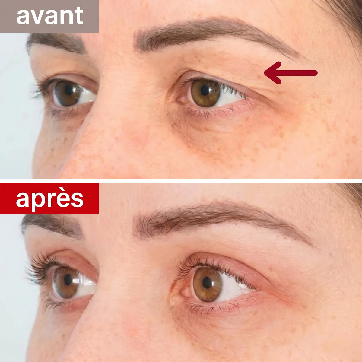 Patchs yeux aux peptides